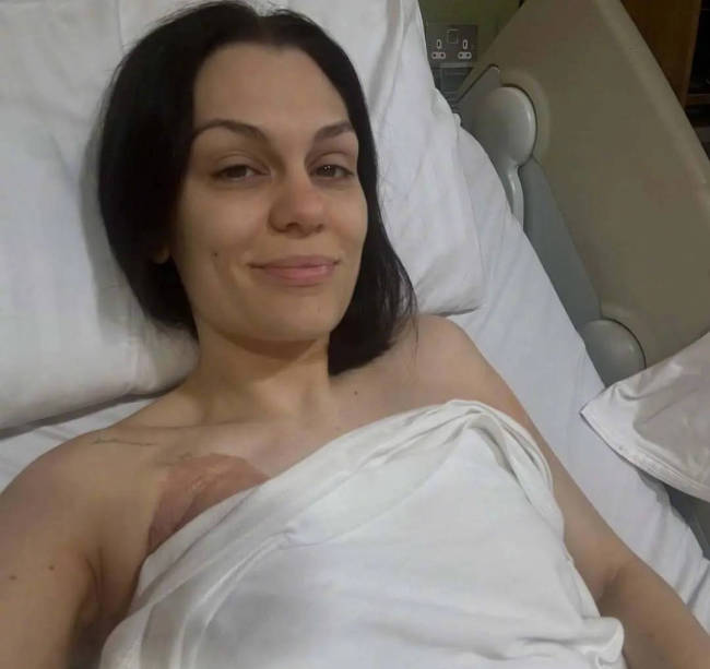 结石姐分享乳腺癌手术照片 躺在病床上满脸憔悴